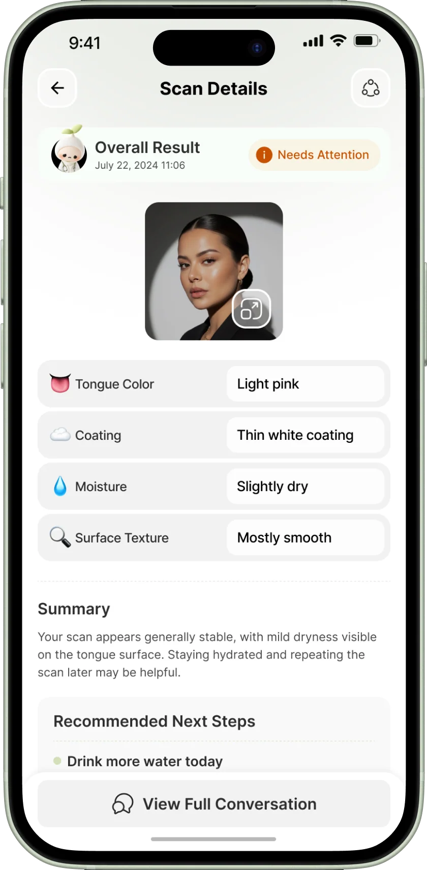 A checkapp scan result with tongue colour, coating, moisture and surface texture readings, a short summary and a recommended next step.